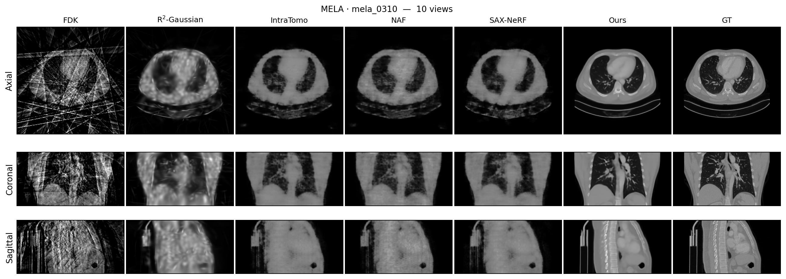 Per-scan optimisation comparison