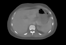 EUReCA reconstruction